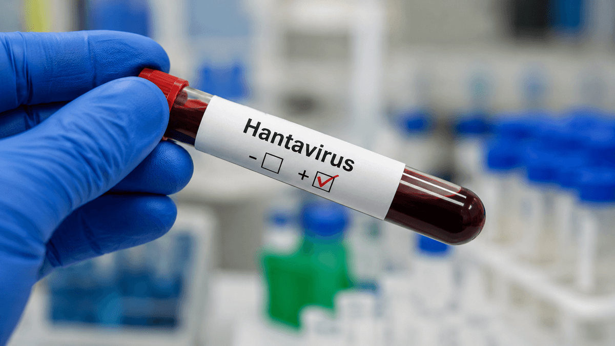 Représentation visuelle du virus hantavirus, agent infectieux de la famille Hantaviridae transmis par les rongeurs